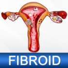 Uterine Fibroid Treatment Help Pro icon